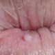 Photo d'un anus en gros plan