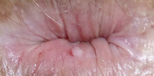 Photo d'un anus en gros plan 